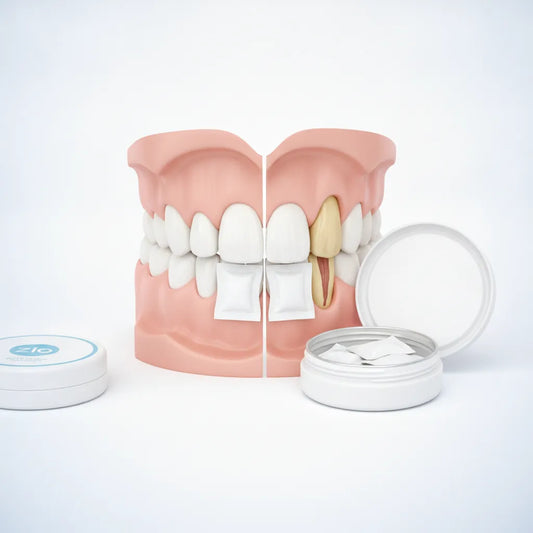 Nicotine Pouch Gum Recession: Causes & Recovery